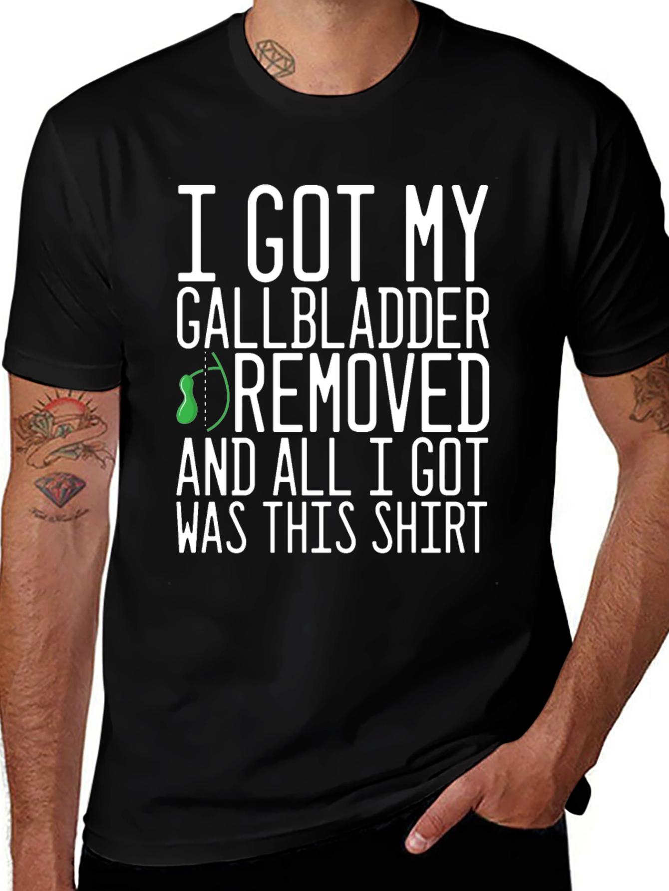 Gallbladder Removed T-Shirt - Funny Recovery Tee